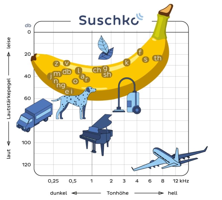 Suschko Sprachbanane